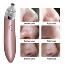 EXTRACTOR DE PUNTOS NEGROS Y ESPINILLAS 🔥[últimas unidades] 🔥